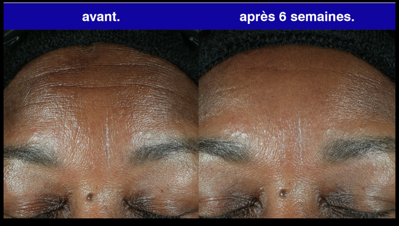Crème au Rétinol – AESTHTANY (50 g)